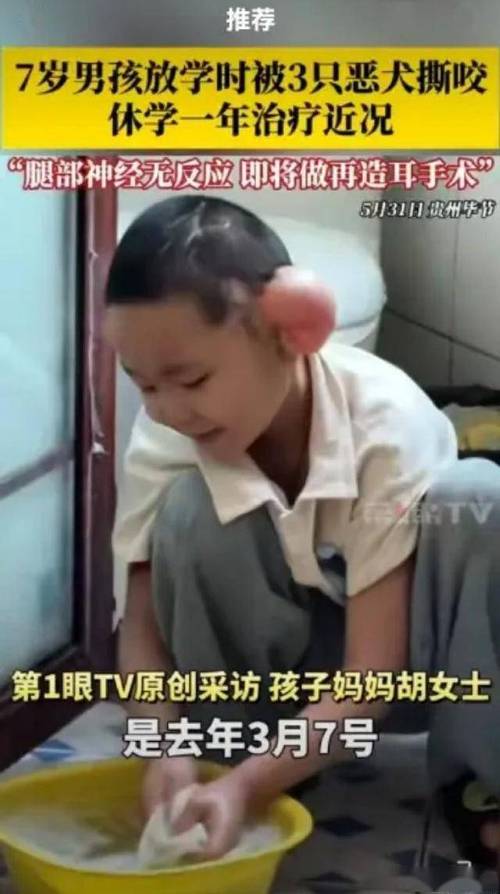 2025全年资料大全正版和7岁男孩遭3只犬撕咬与7岁男孩遭3只犬撕咬怎么办