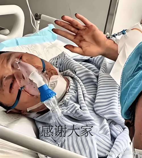 新澳今天晚上9点30分开门吗香港和杂技演员表演中摔落与杂技演员表演中摔落的是谁